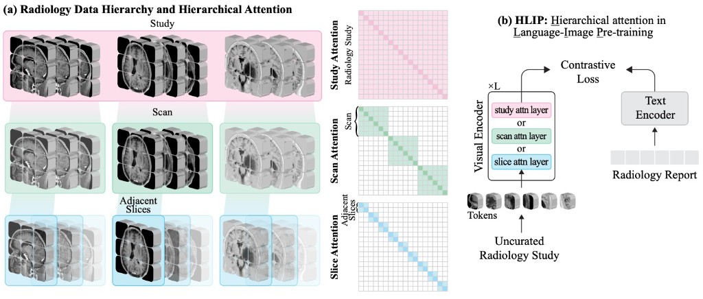 Figure from Towards scalable language-image pre-training for 3D medical imaging