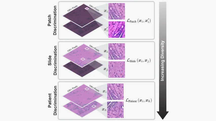 Figure from Hierarchical discriminative learning improves visual representations of biomedical microscopy