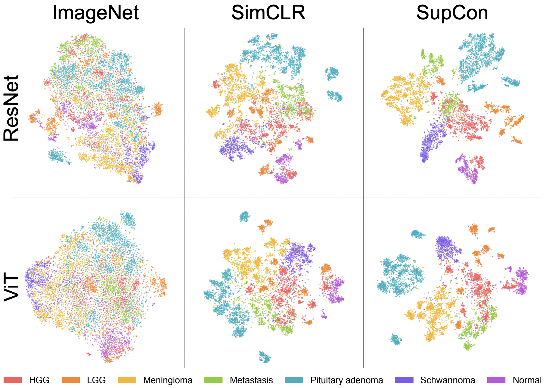 Figure from OpenSRH: optimizing brain tumor surgery using intraoperative stimulated Raman histology
